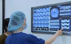 Niềng răng để đẹp, đừng để... “trả giá” vì nhầm chỗ