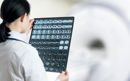 Não đàn ông "teo" nhanh hơn phụ nữ