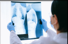 HTV Chiến thắng ung thư: Chụp X-quang, CT có gây ung thư không?