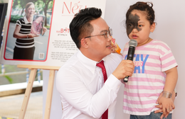 "Nếu là tôi": Triển lãm nhân văn về những người mang bớt bẩm sinh