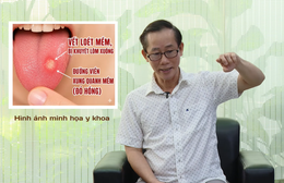 HTV Chiến thắng ung thư: Ung thư lưỡi dễ nhầm với nhiệt miệng