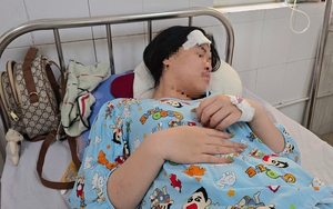 Phản ứng hành vi khiếm nhã, cô gái bị người đàn ông đánh tét đầu trong quán cà phê