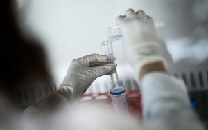 Hà Nội dự định mua ‘siêu máy’ nghìn tỷ điều trị ung thư