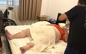 Du khách nặng gần 300kg mắc kẹt trong nhà vệ sinh ở Đà Nẵng