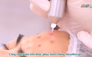 Thực hư trẻ hóa da bằng Mesotherapy