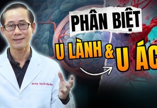 HTV Chiến thắng ung thư: Phân biệt u lành tính và u ác tính
