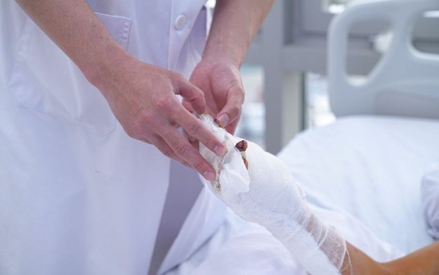 Một số lưu ý khi gặp tai nạn liên quan đến pháo