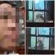 Bé gái bị mẹ kế đánh ở Phú Thọ có dấu hiệu bị bạo hành trước đó