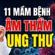 11 tác nhân gia tăng nguy cơ ung thư | HTV Chiến thắng ung thư